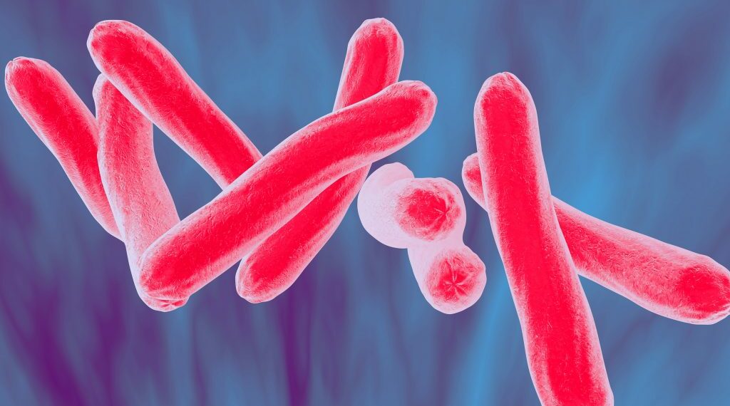 Why have TB eradication efforts been so slow?