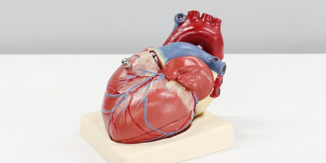 Now, AI warns of heartbeat irregularities before they strike