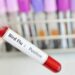 First H9N2 bird flu case detected in Indian 4-yr-old since 2019; WHO monitors situation