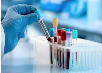 Assam: IASST Guwahati researchers develop optical sensing platform for cholesterol detection