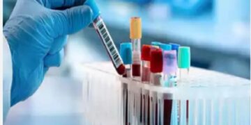 Assam: IASST Guwahati researchers develop optical sensing platform for cholesterol detection