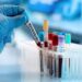 Assam: IASST Guwahati researchers develop optical sensing platform for cholesterol detection